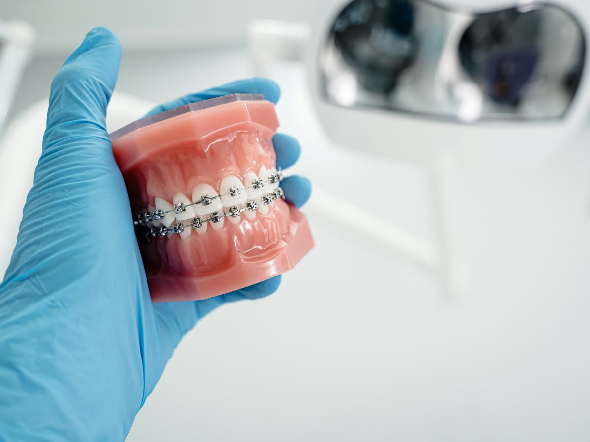 Dental Implant